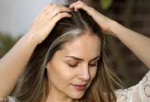Receding Hairline Women